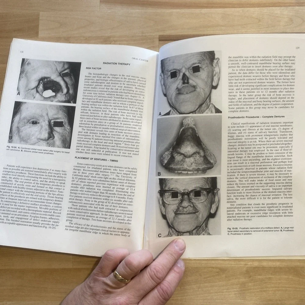 Oral‎ Cancer by Sol Silverman Jr 1985 American Cancer Society Second Edition